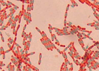 Tinción de endospora Bacillus subtilis